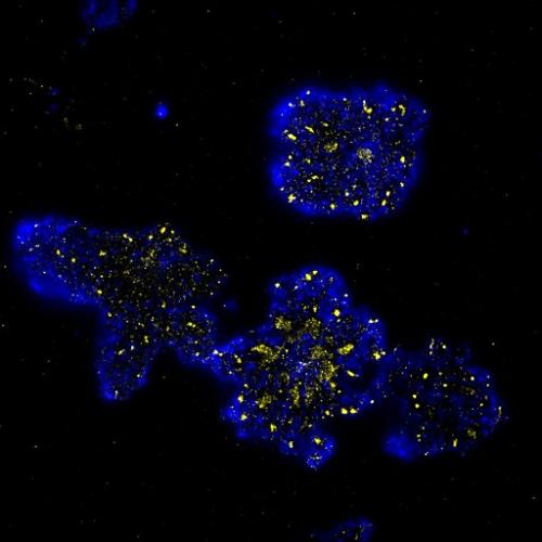 Microscopy image of T cells bearing chimeric antigen receptors; negative regulator, blue, a recruited signalling kinase, yellow