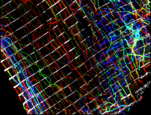 microscopy image showing different elements of the cytoskeleton of a heart muscle cell