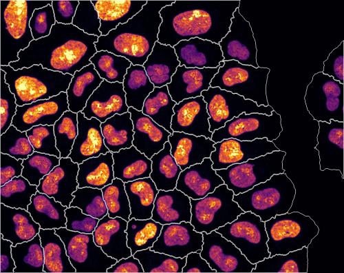mage: Metabolic labelling with fluorescent dye indicates rate of RNA production. Image analysis measured the size, growth phase and rate of RNA production of every single cell