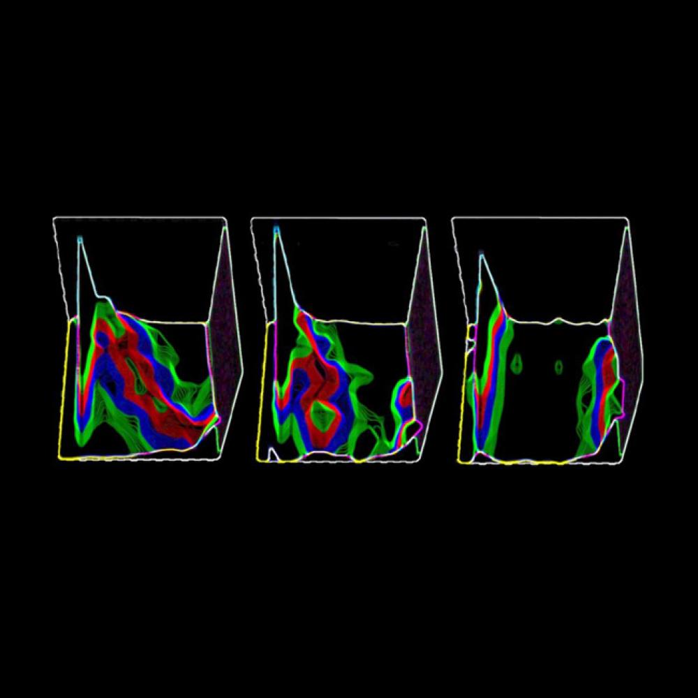 Watching proteins at work