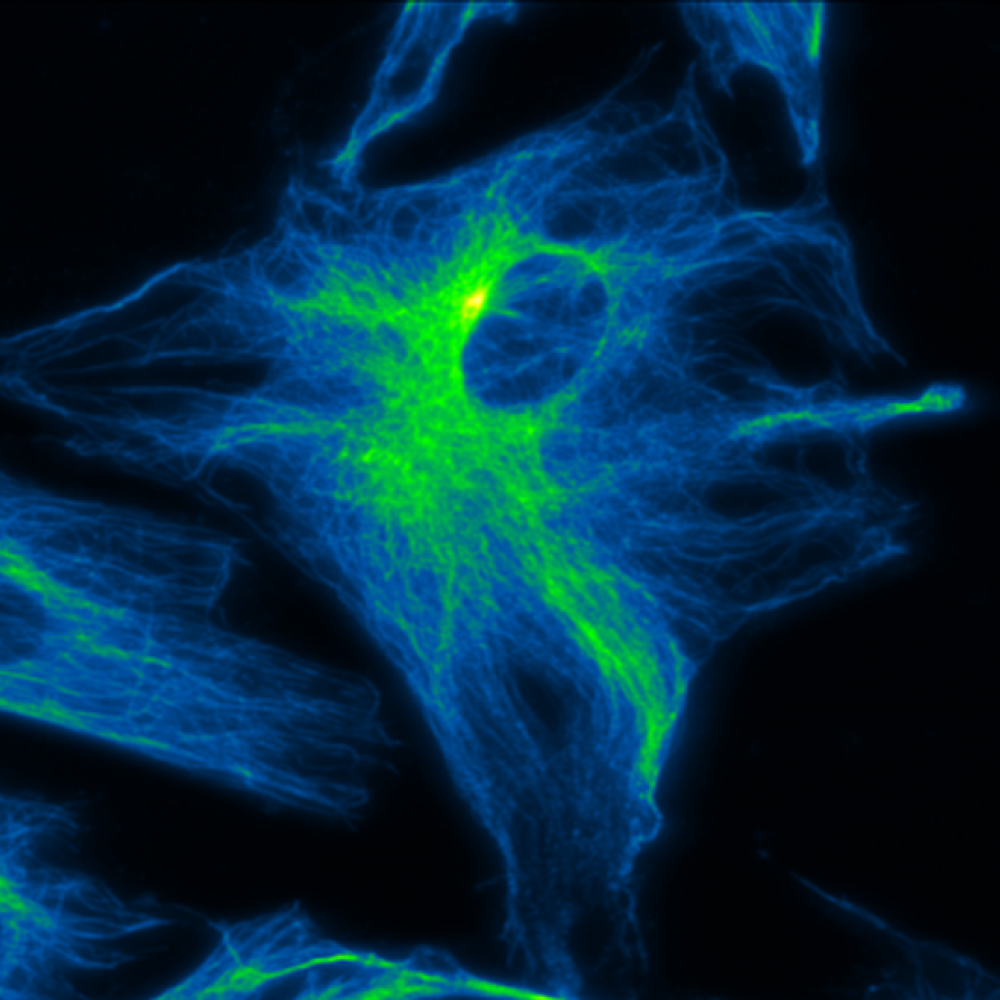 Inner workings of a cell - UNSW SMS research 