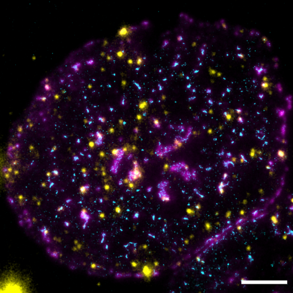 T cell receptor (magenta), ZAP70 (cyan) and another signalling protein (LAT, yellow) in an activated T cell