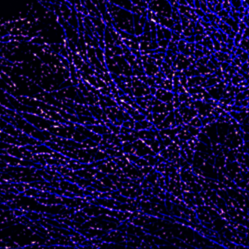 Dynein must bind to dynactin (magenta) and cargo before it can actively move toward the cell's centre, along microtubules (blue). Image provided