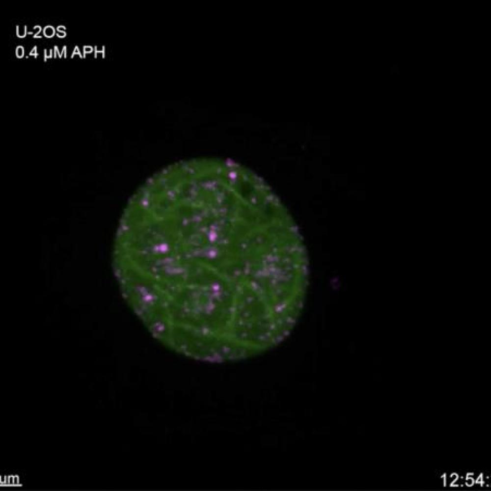 Cancer cells in replication stress