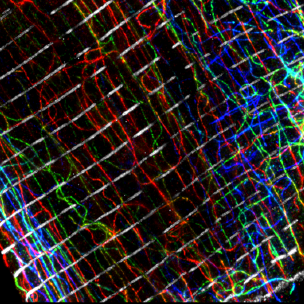 microscopy image showing different elements of the cytoskeleton of a heart muscle cell