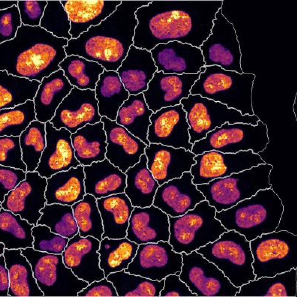 mage: Metabolic labelling with fluorescent dye indicates rate of RNA production. Image analysis measured the size, growth phase and rate of RNA production of every single cell