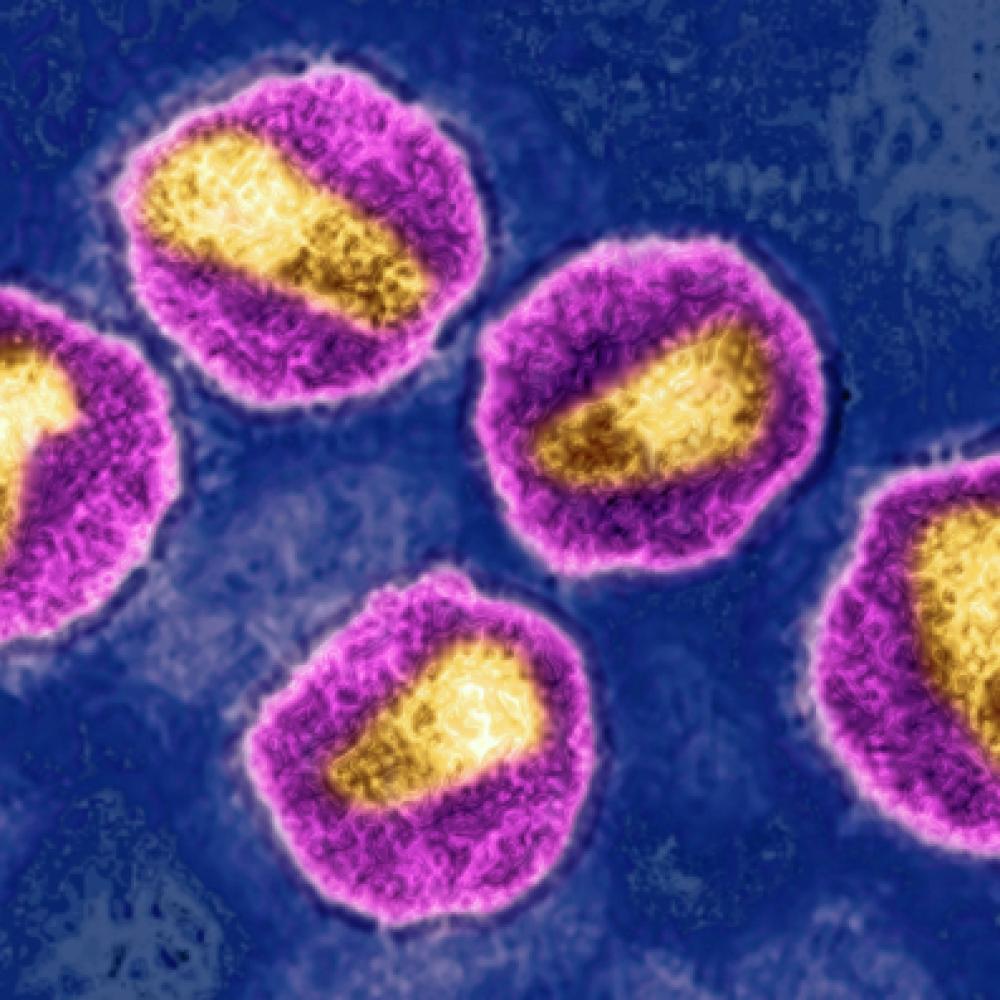 HIV virus. Image produced from an image taken with transmission electron microscopy. Image: Getty Images