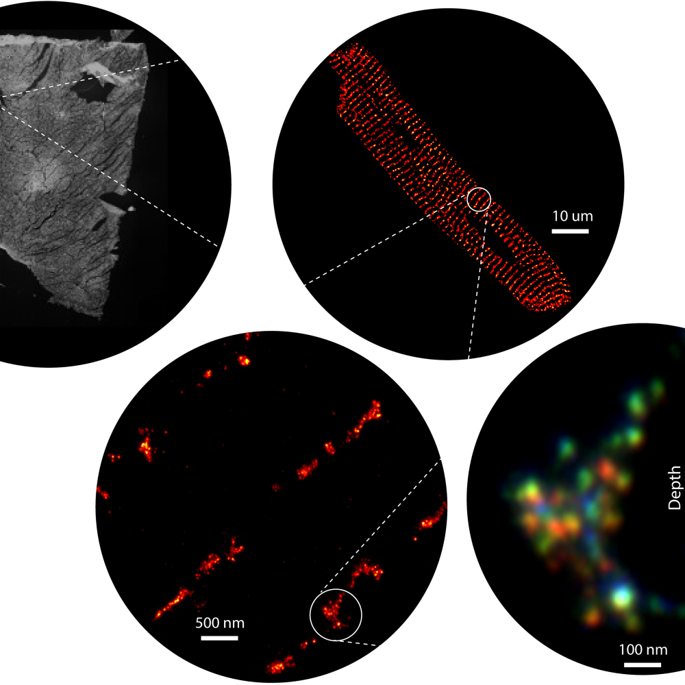Signalling Nanodomains